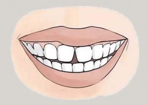 <a href=http://lzsina.cn/news_article?news_id=116>一次性口腔探針</a>